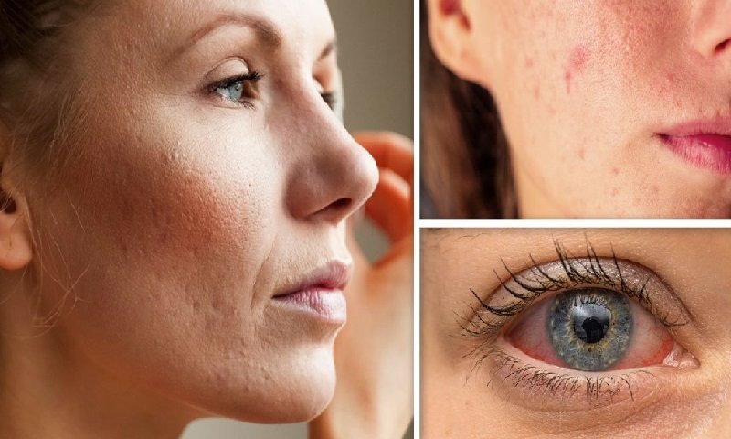 prevenir-las-alergias-que-causa-el-maquillaje