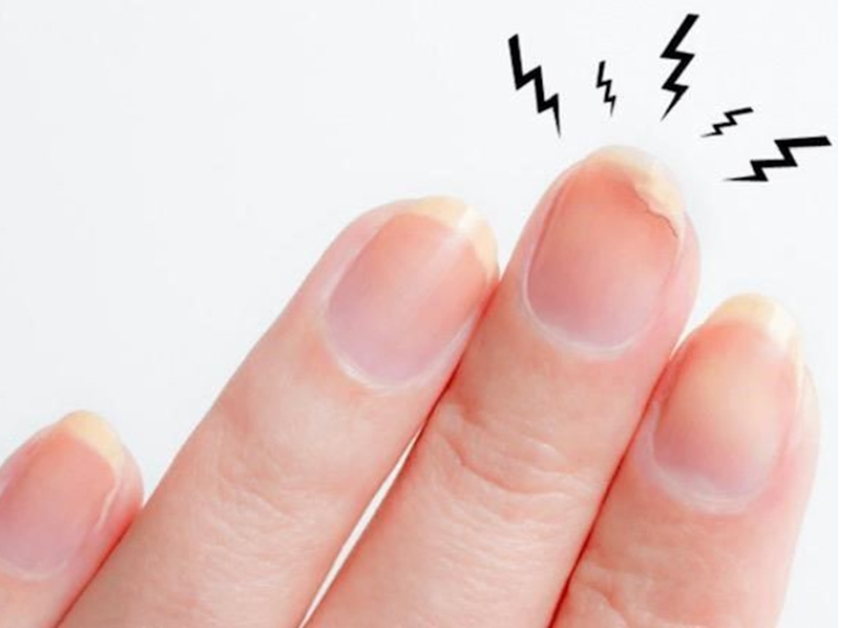 Cuidar las uñas frágiles