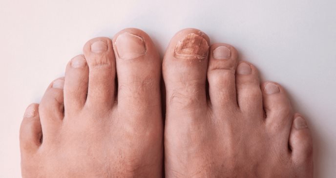 El cuidado de las uñas de los pies