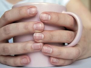 La salud de las uñas