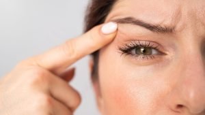 Inicio Los párpados encapotados