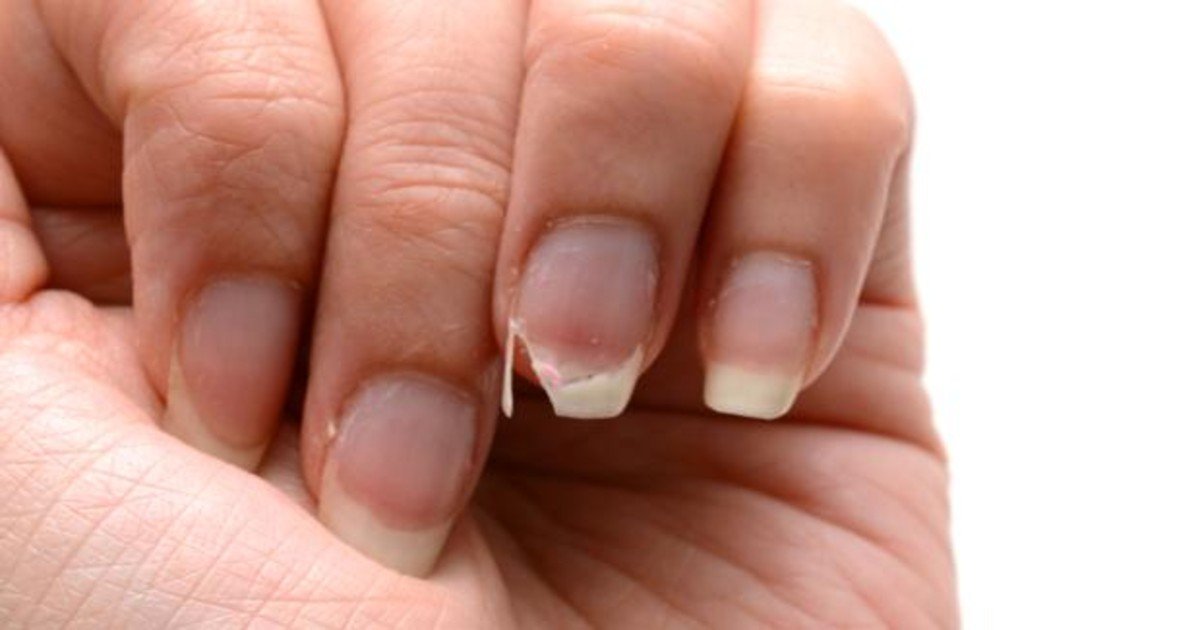 Los problemas de salud de las uñas