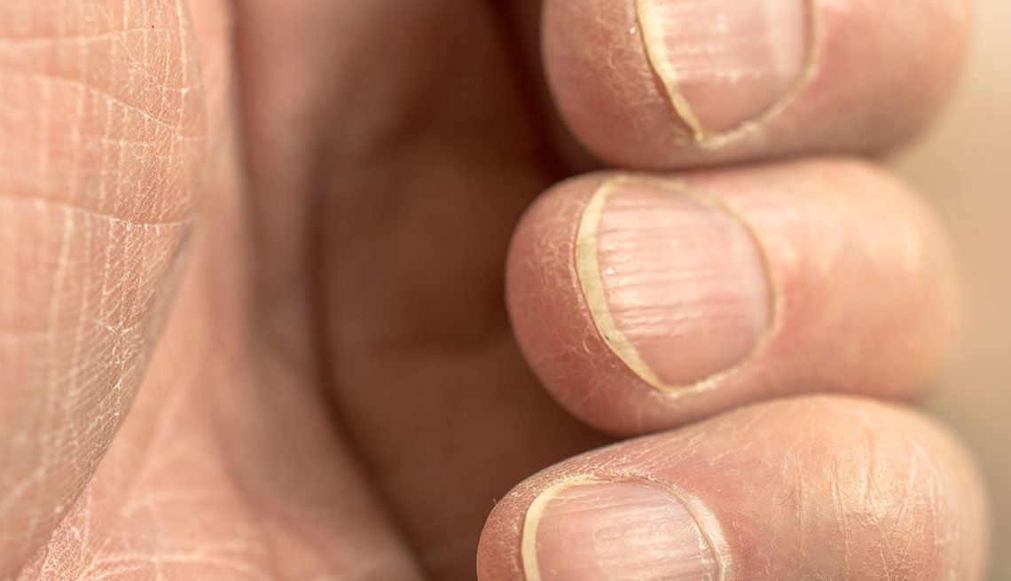 Los problemas de salud de las uñas