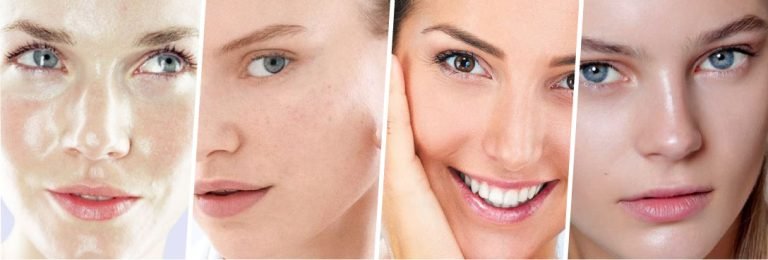 ¿Cuáles son las cremas rejuvenecedoras para los tipos de piel?