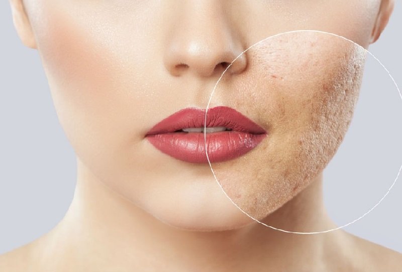 Cómo-el-maquillaje-puede-afectar-la-salud-de-la-cara