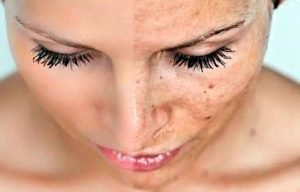problemas-que-puede-causar-el-uso-excesivo-de-maquillaje